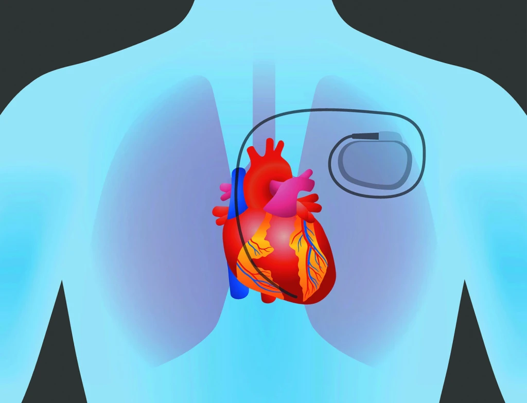 Sudden Cardiac Deaths: Looking the other way till it actually strikes?